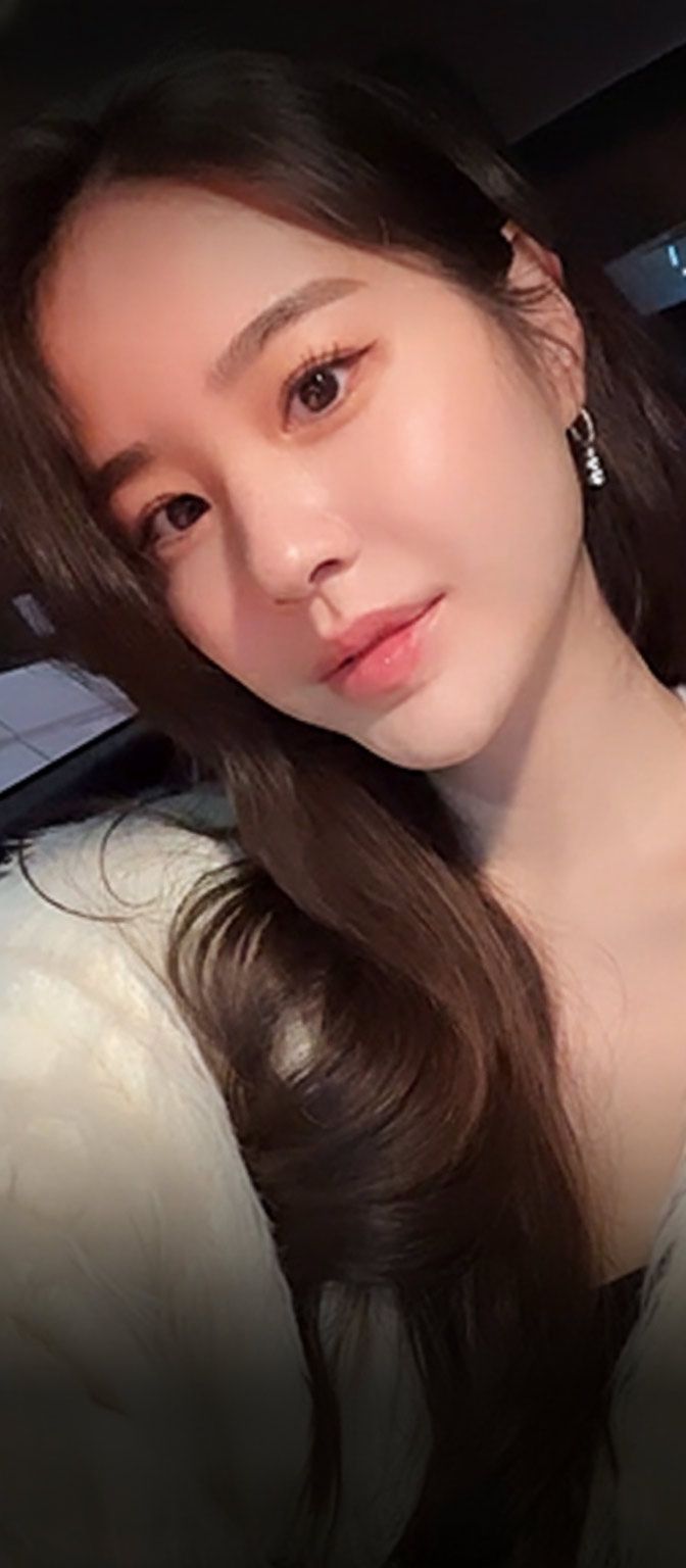 스케치성형외과 Shorts: 절개눈매교정, 눈재수술