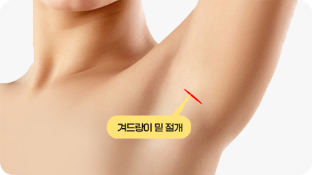 겨드랑이 절개법