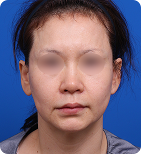 세미거상 정면 전