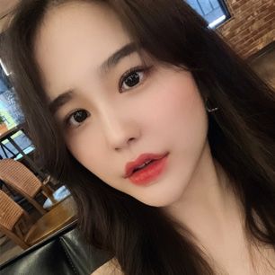 스케치성형외과 리얼 셀카 2