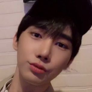 스케치성형외과 리얼 셀카 2