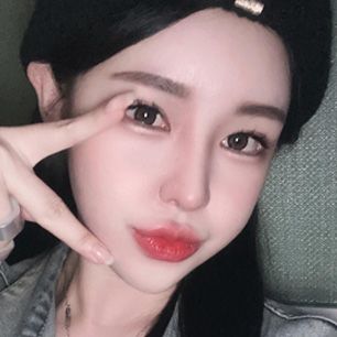 스케치성형외과 리얼 셀카 1