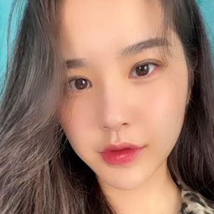 스케치성형외과 리얼 셀카 1